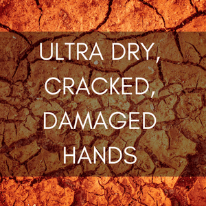 Ultra Dry, Cracked, Damaged Hands